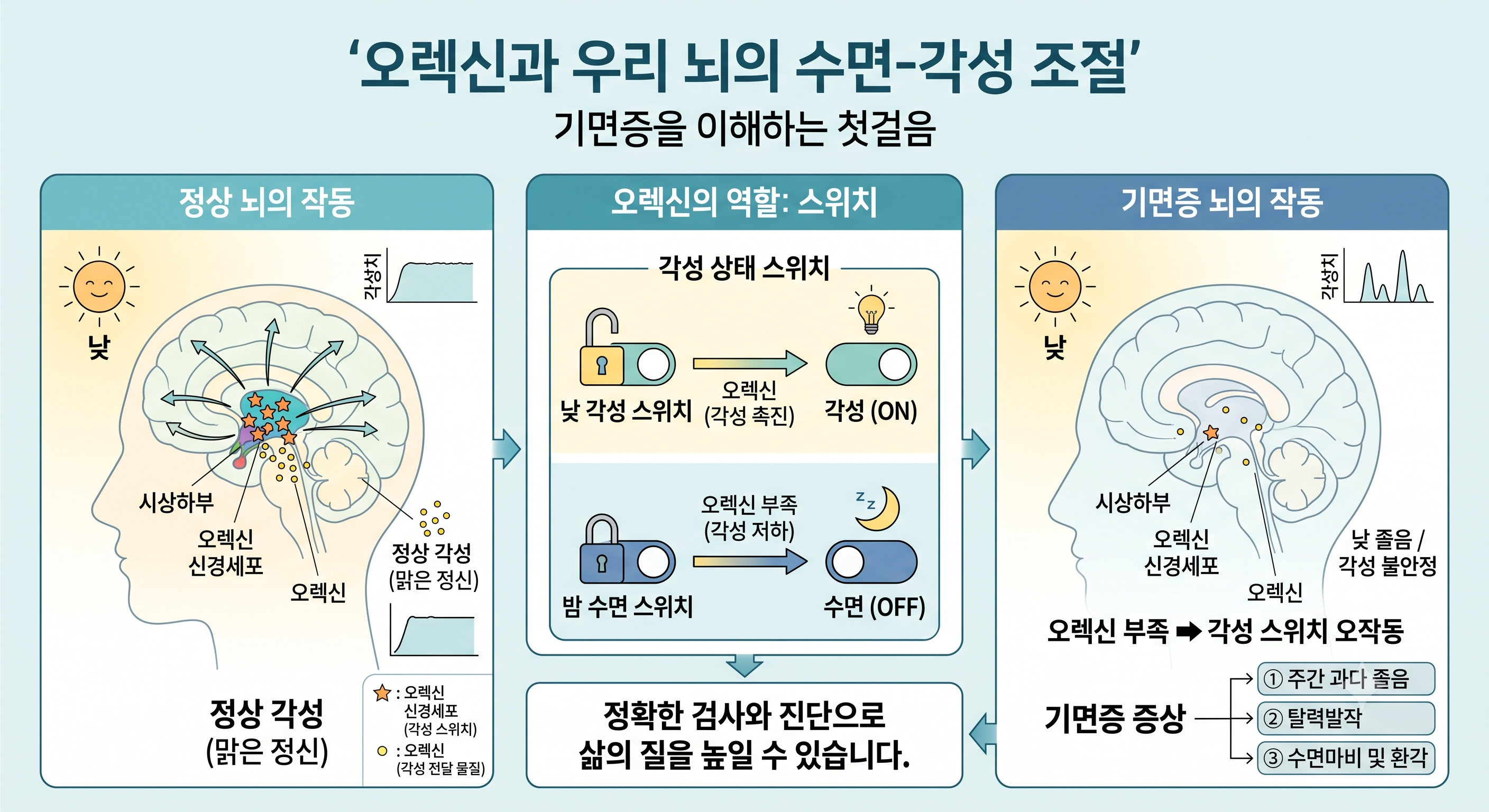 [김재하 원장 칼럼] 낮에 쏟아지는 잠과 탈력발작, 스탠퍼드 수면의학으로 풀어보는 기면증 검사 이야기 (인천수면다원검사 병원, 인천기면증)