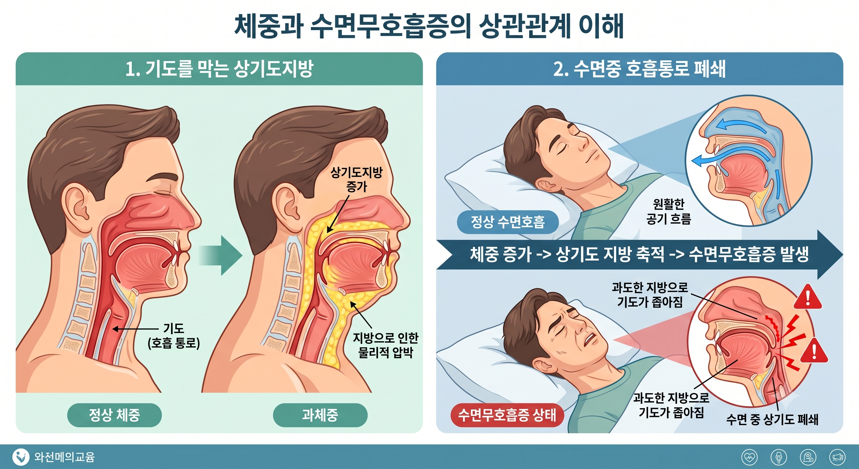 수면무호흡증 환자라면, 비만 주사 실비보험이 적용가능한가요?