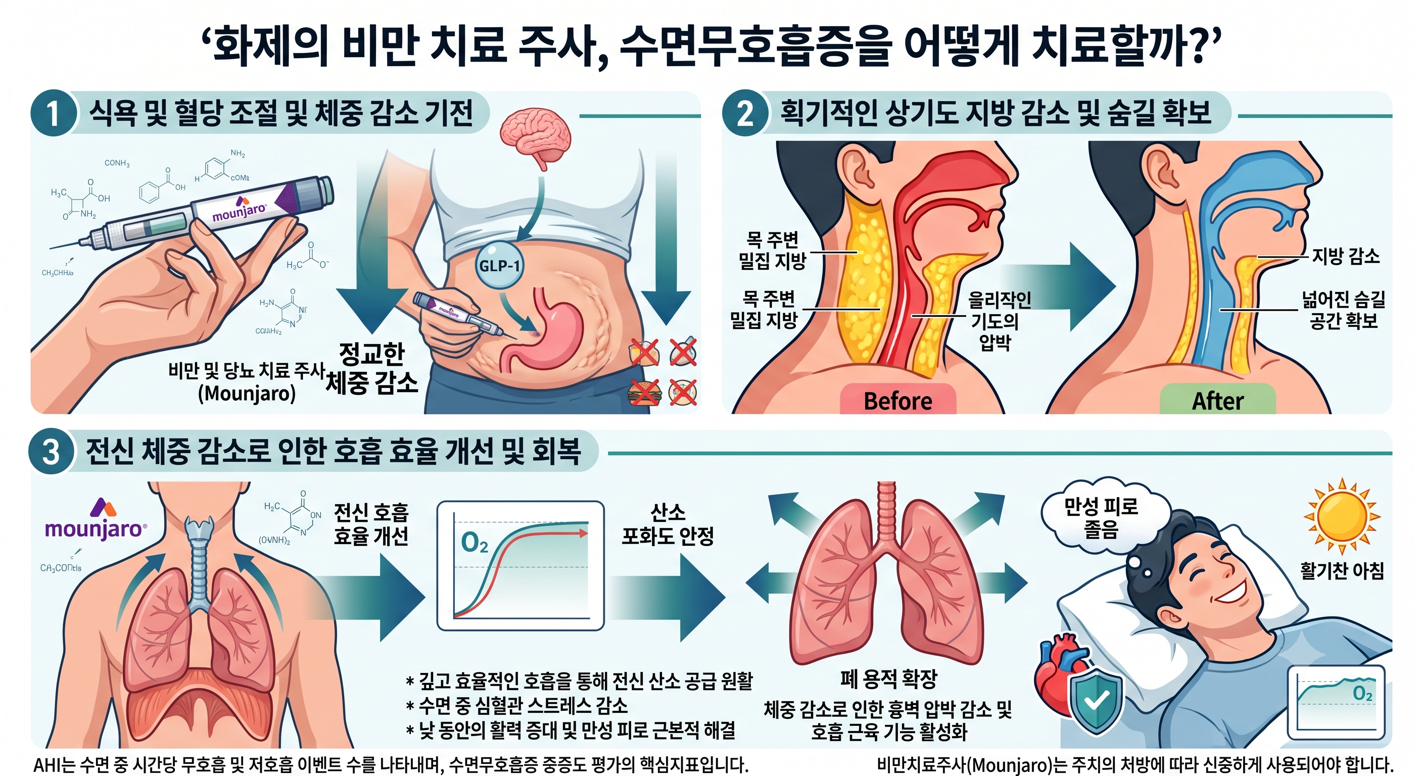 수면무호흡증 환자라면, 비만 주사 실비보험이 적용가능한가요?