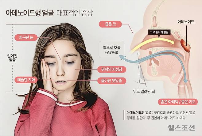 아이 코골이, 그냥 잠버릇일까요?