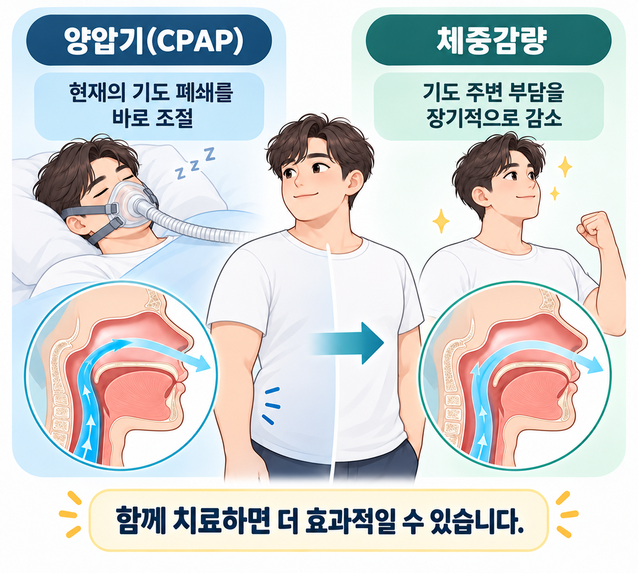 살찌고 코골이가 심해졌다면? - 비만 수면무호흡증 검사와 체중감량 치료